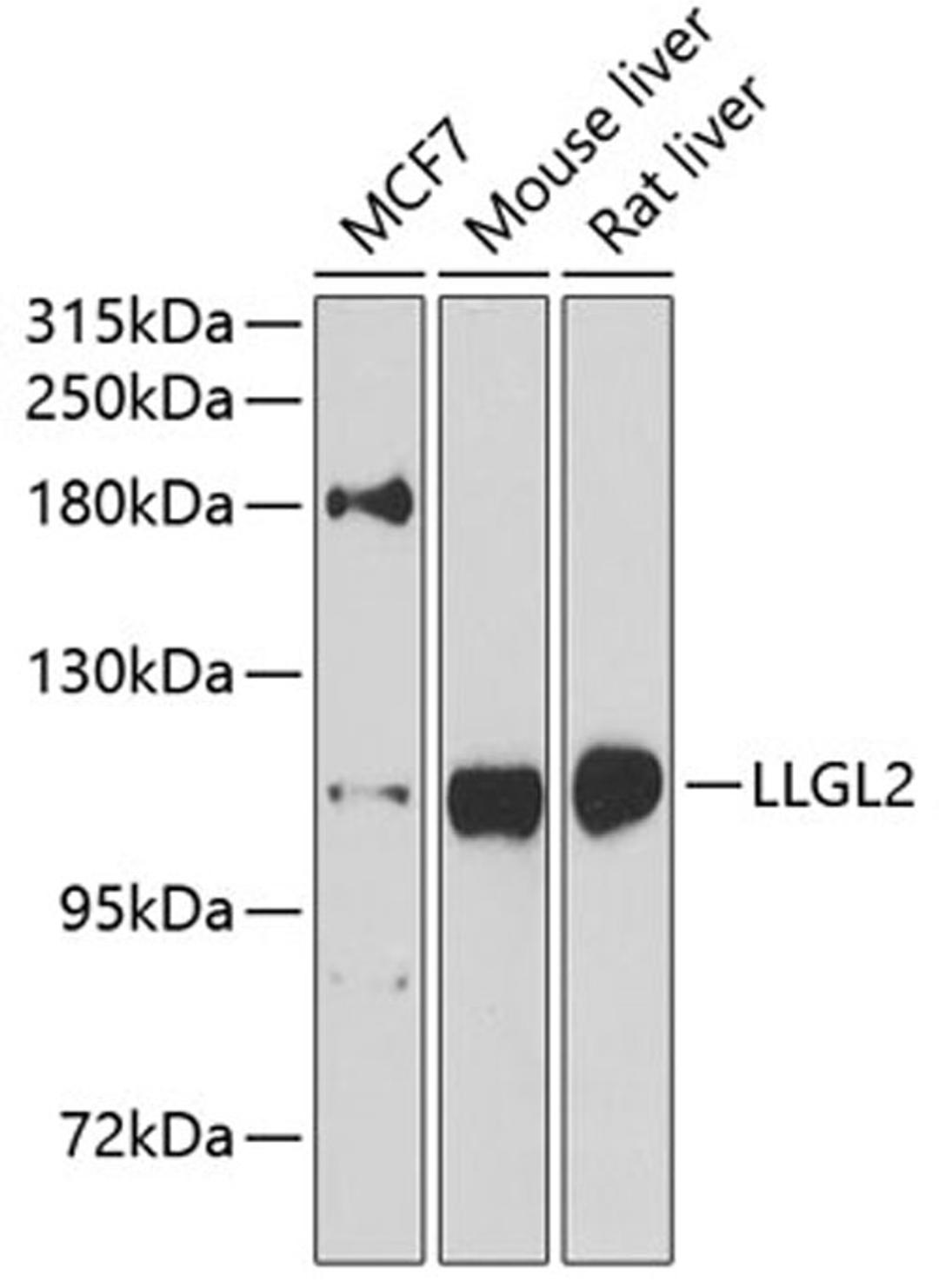 Western blot - LLGL2 antibody (A8284)