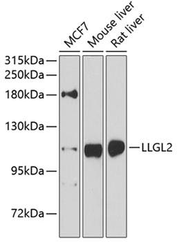 Western blot - LLGL2 antibody (A8284)