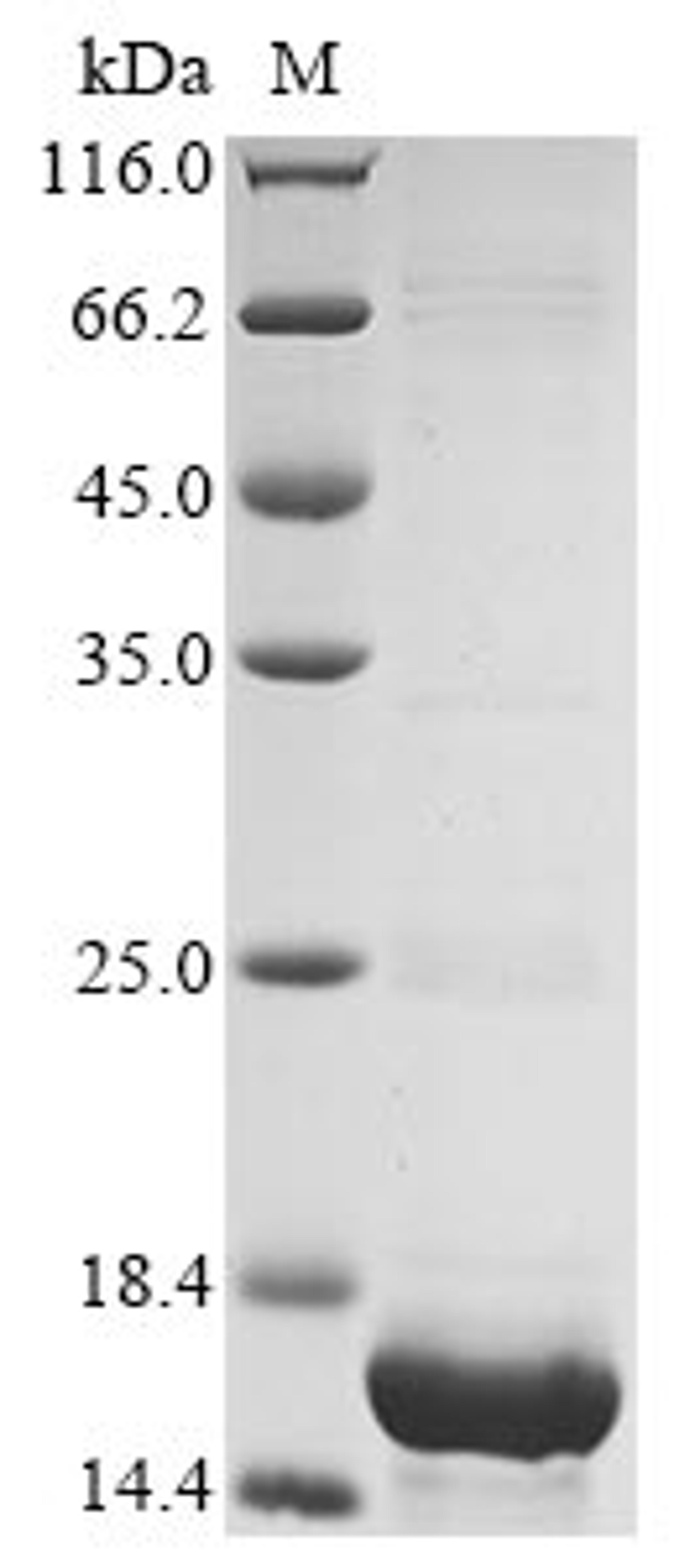 (Tris-Glycine gel) Discontinuous SDS-PAGE (reduced) with 5% enrichment gel and 15% separation gel.