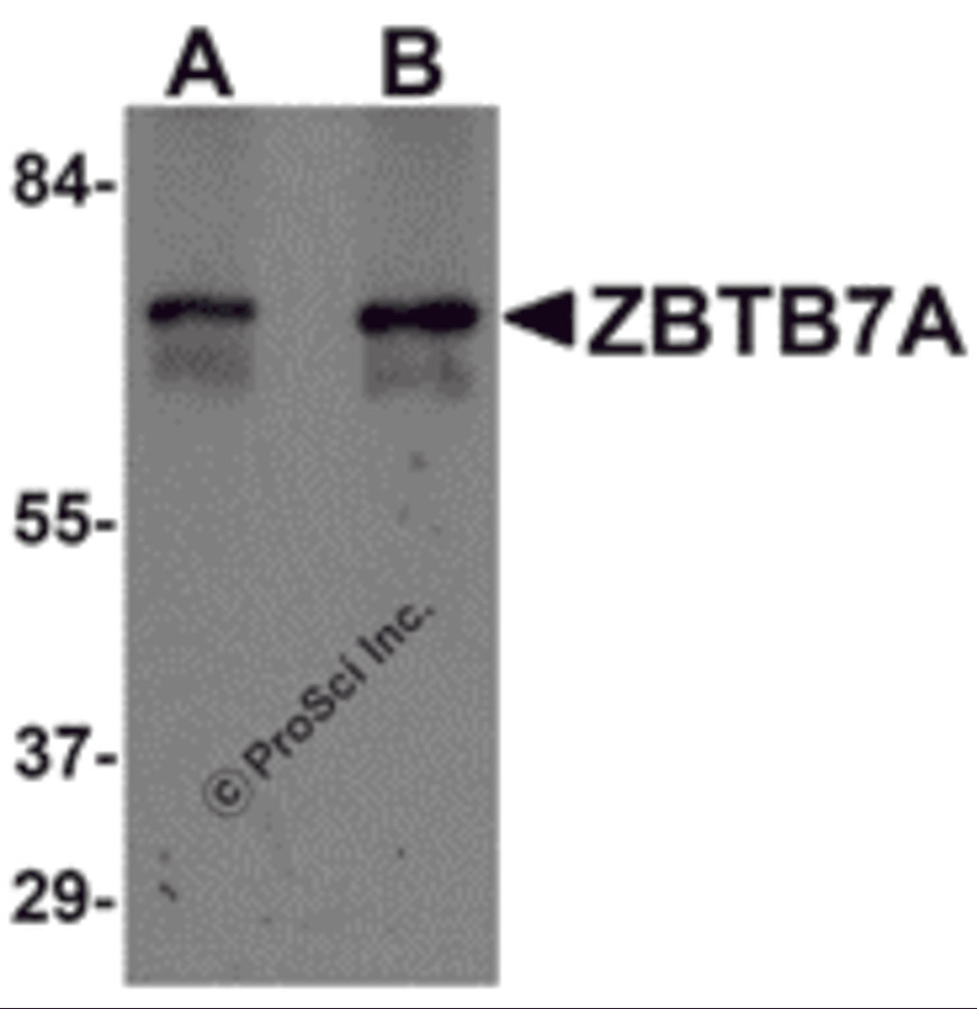 Western blot analysis of ZBTB7A in human ovary tissue lysate with ZBTB7A antibody at (A) 1 and (B) 2 &#956;g/mL.