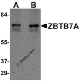 Western blot analysis of ZBTB7A in human ovary tissue lysate with ZBTB7A antibody at (A) 1 and (B) 2 μg/mL.