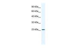 Antibody used in WB on Human HepG2 at 1.25 ug/ml.