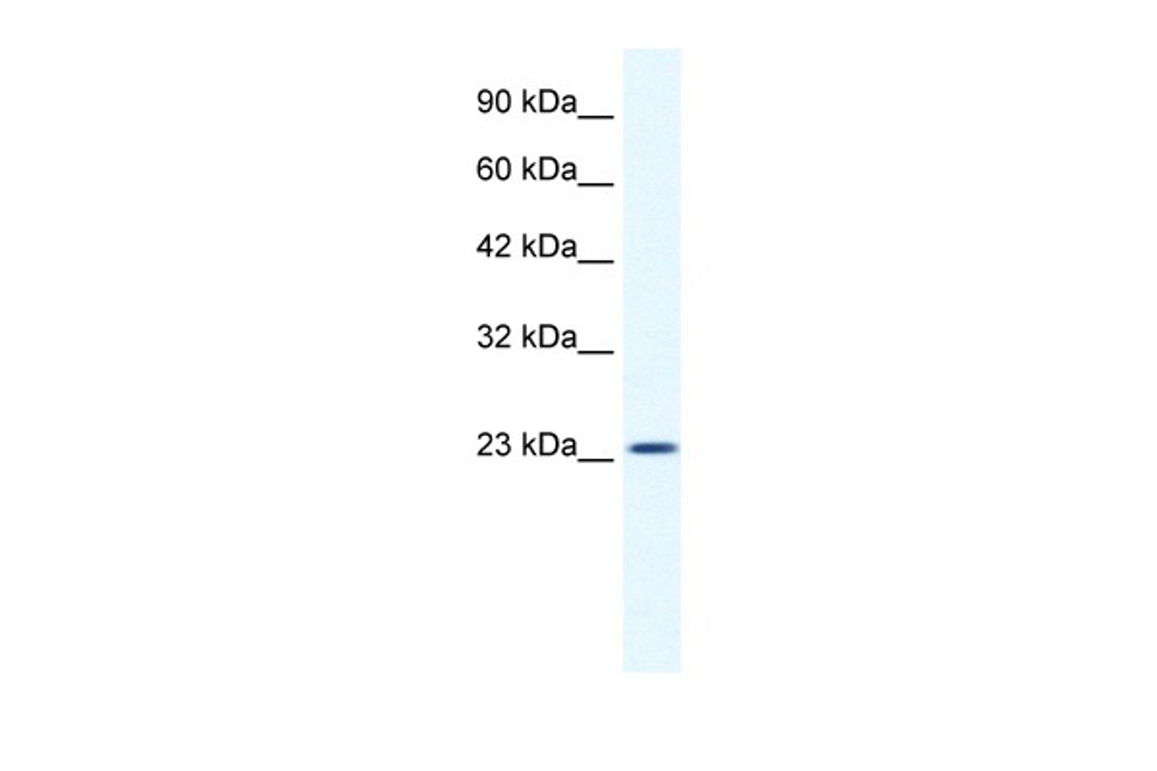 Antibody used in WB on Human HepG2 at 1.25 ug/ml.