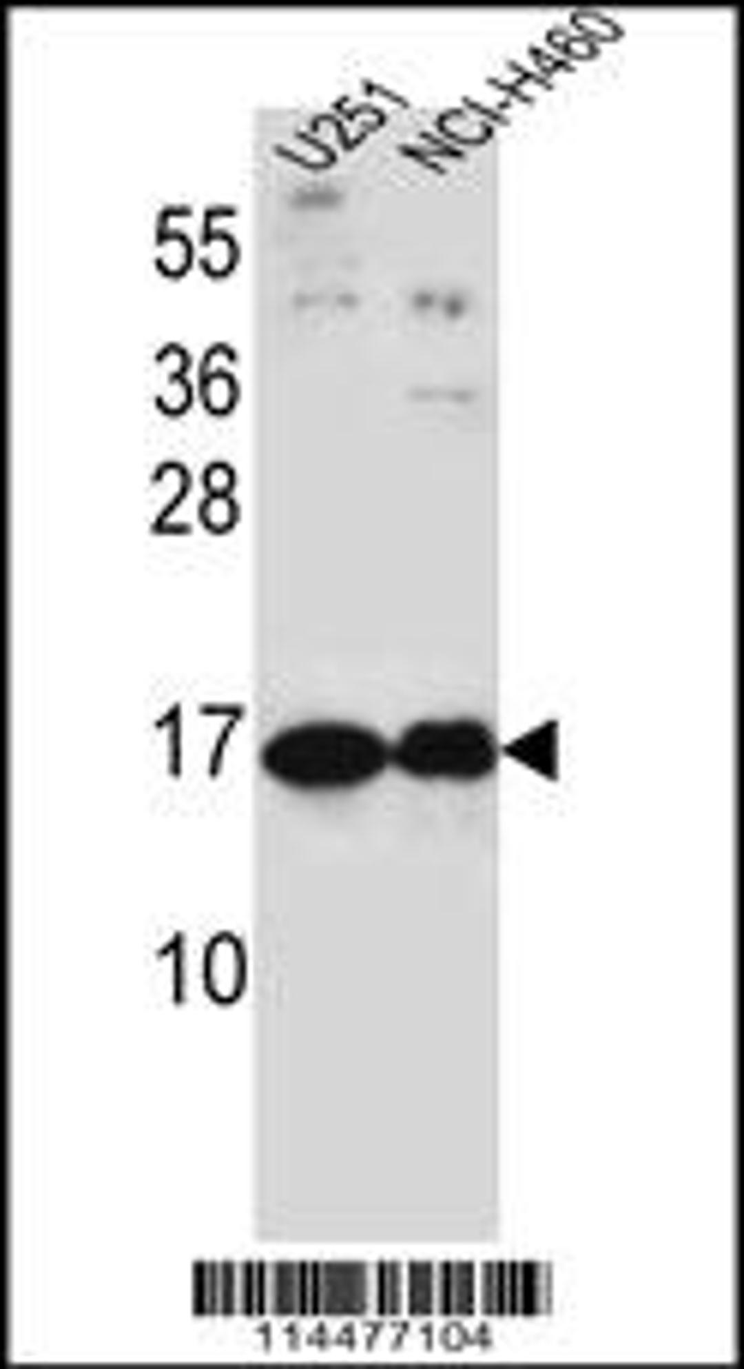 Western blot analysis in U251,NCI-H460 cell line lysates (35ug/lane).