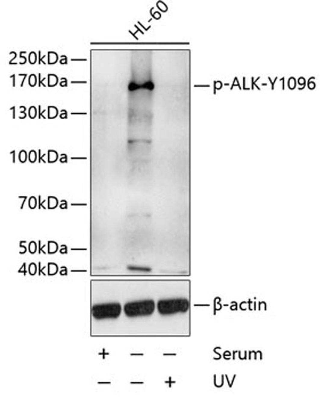 Western blot - Phospho-ALK-Y1096 antibody (AP0503)