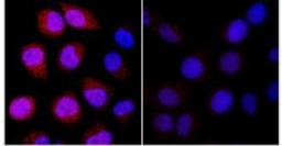 Immunoprecipitation: DDIT4 Antibody [NBP1-22966] - NBF-fixed asynchronous HeLa cells. Cobalt treated cells (left) or mock treated cells (right) immunostained for REDD1. Affinity purified rabbit anti-REDD1 1:100.