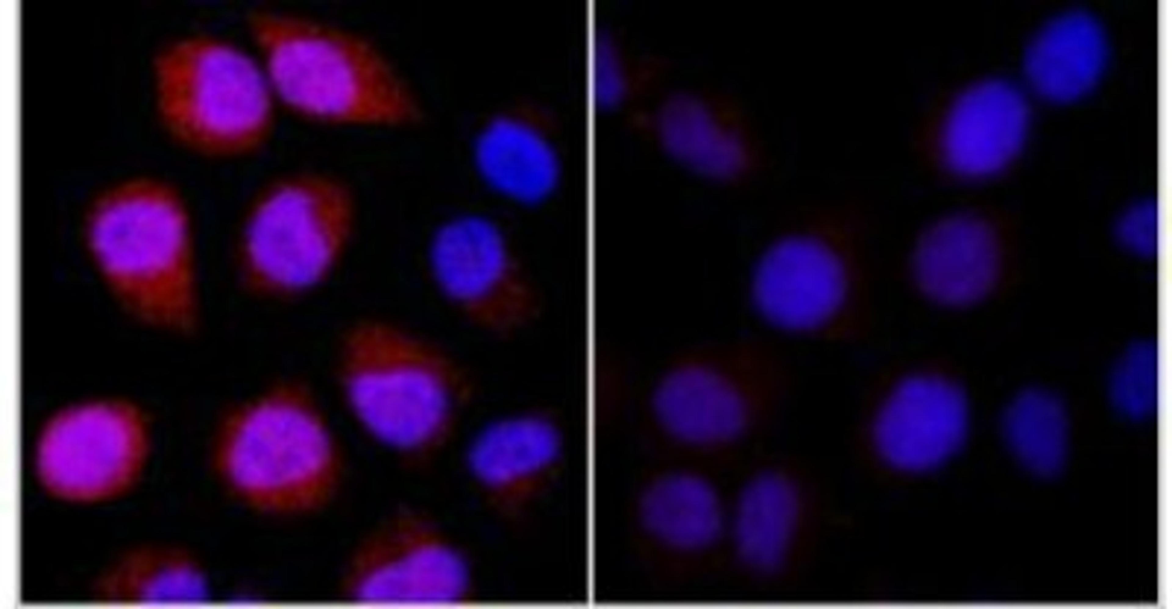 Immunoprecipitation: DDIT4 Antibody [NBP1-22966] - NBF-fixed asynchronous HeLa cells. Cobalt treated cells (left) or mock treated cells (right) immunostained for REDD1. Affinity purified rabbit anti-REDD1 1:100.