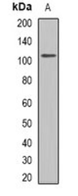 Western blot analysis of rat kidney (Lane 1) whole cell lysates using GLUR1 antibody