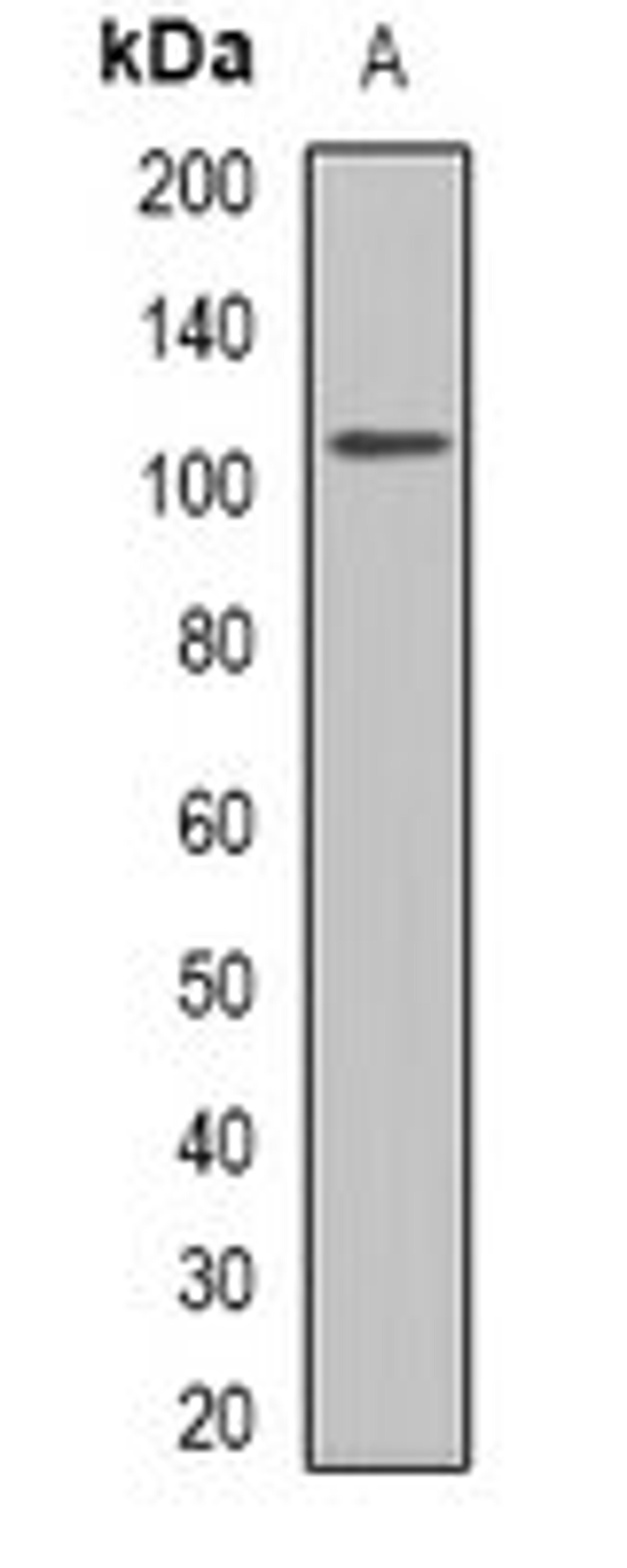 Western blot analysis of rat kidney (Lane 1) whole cell lysates using GLUR1 antibody