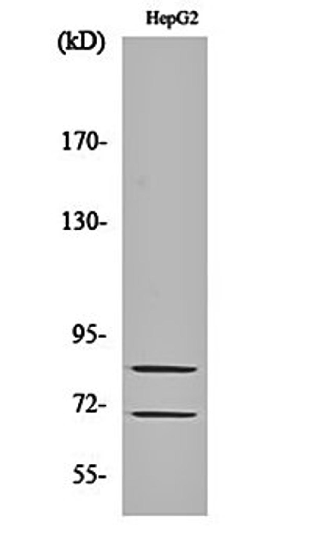 Western blot analysis of HepG2 cell lysates using Choactase antibody