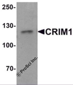 Western blot analysis of CRIM1 in Jurkat cell lysate with Crim1 antibody at 1 &#956;g/mL.