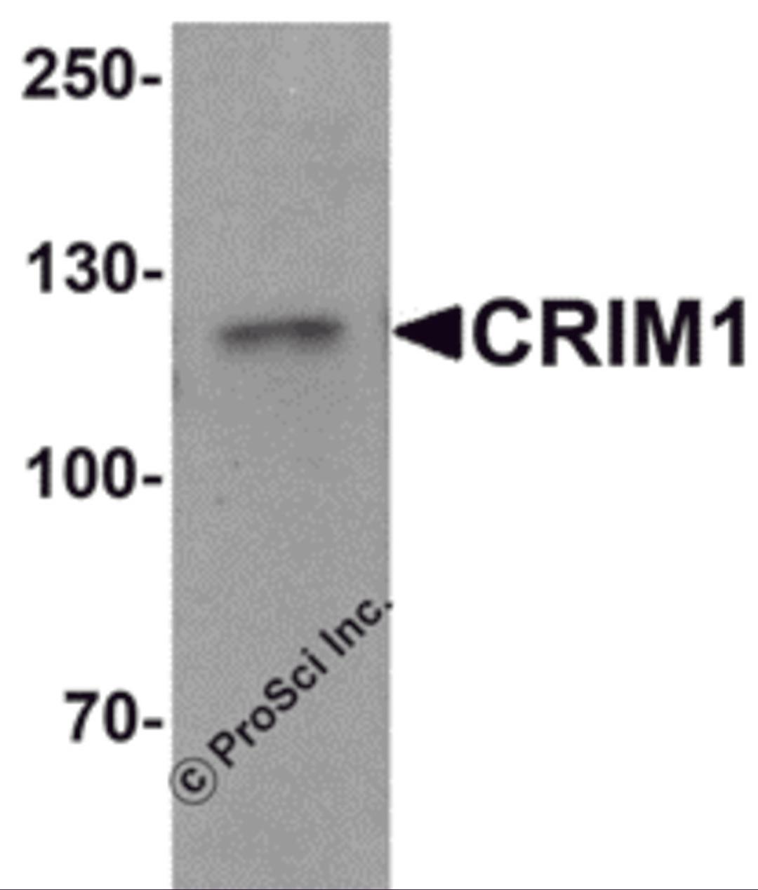 Western blot analysis of CRIM1 in Jurkat cell lysate with Crim1 antibody at 1 μg/mL.