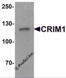 Western blot analysis of CRIM1 in Jurkat cell lysate with Crim1 antibody at 1 μg/mL.