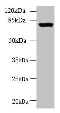 Western blot. All lanes: CLPB antibody at 5ug/ml + 293T whole cell lysate. Secondary. Goat polyclonal to rabbit IgG at 1/10000 dilution. Predicted band size: 79, 76, 73, 75, 58 kDa. Observed band size: 79 kDa. 