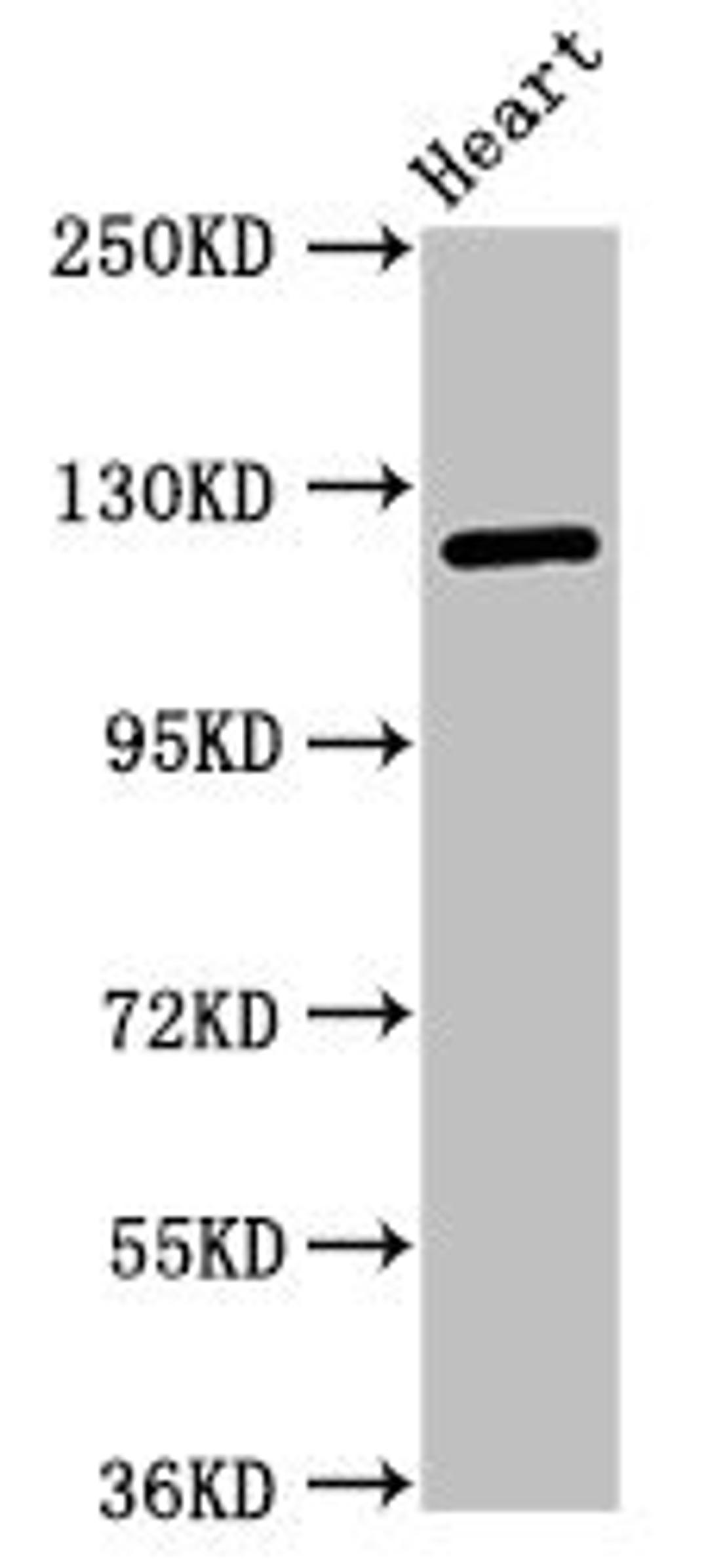 Western Blot. Positive WB detected in: Mouse heart tissue. All lanes: SEMA5B antibody at 1ug/ml. Secondary. Goat polyclonal to rabbit IgG at 1/50000 dilution. Predicted band size: 126, 120, 124, 132 kDa. Observed band size: 126 kDa.
