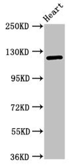 Western Blot. Positive WB detected in: Mouse heart tissue. All lanes: SEMA5B antibody at 1ug/ml. Secondary. Goat polyclonal to rabbit IgG at 1/50000 dilution. Predicted band size: 126, 120, 124, 132 kDa. Observed band size: 126 kDa.