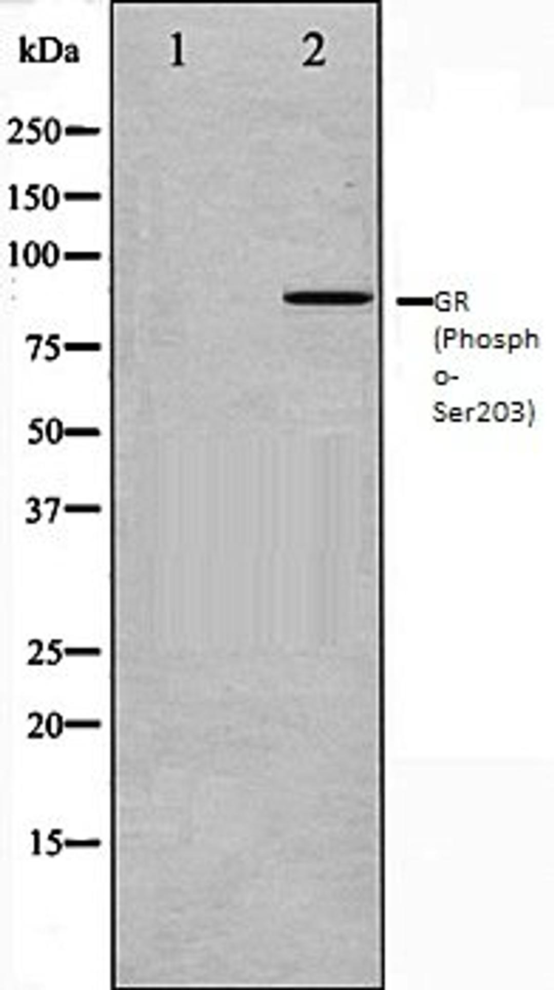 Western blot analysis of A549 whole cell lysates using GR (Phospho-Ser203) antibody, The lane on the left is treated with the antigen-specific peptide.