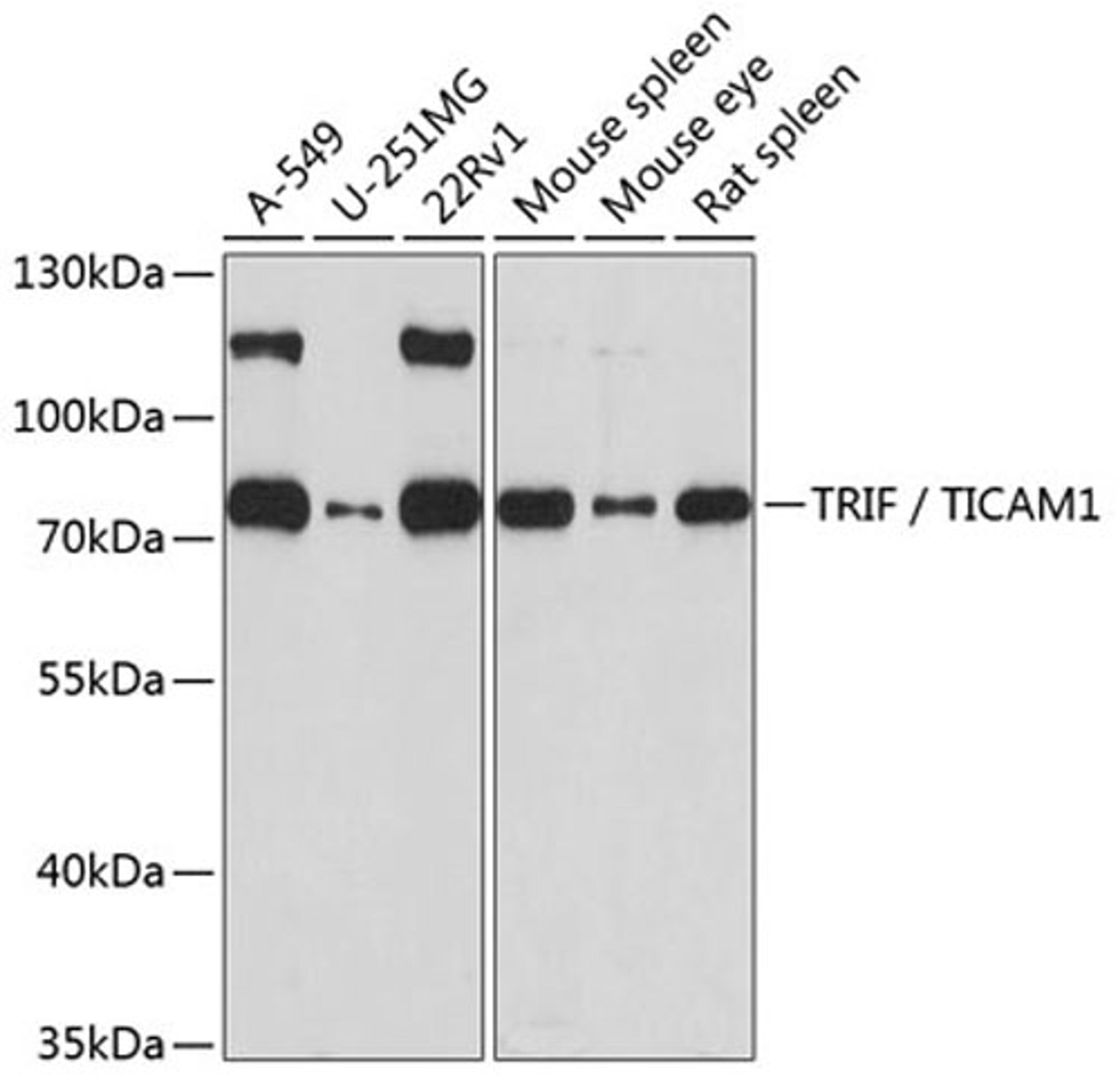 Western blot - TRIF / TICAM1 antibody (A1155)