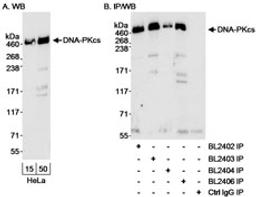 Detection of human DNA-PKcs by western blot and immunoprecipitation.