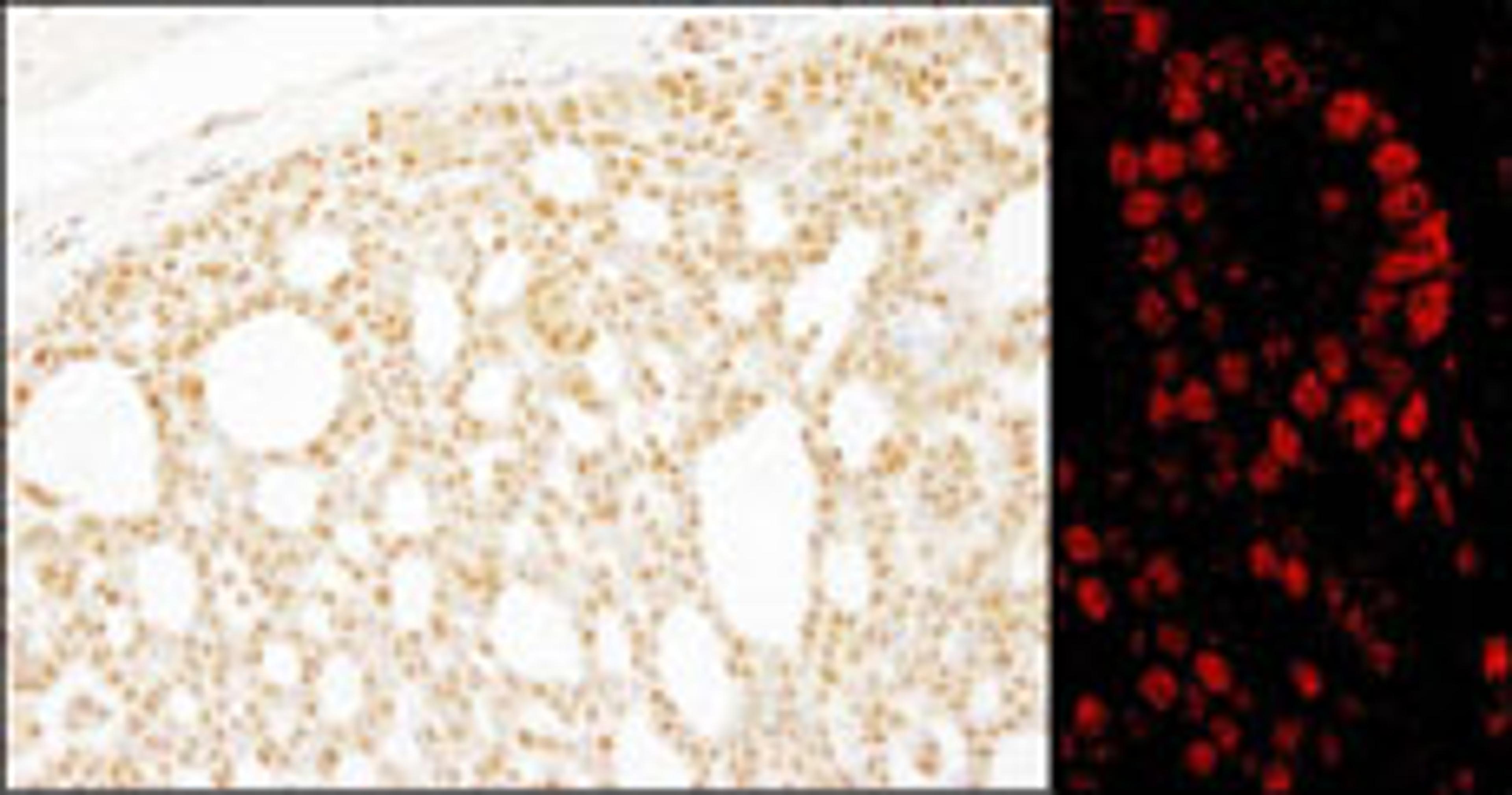 Detection of human Pds5B by immunohistochemistry.