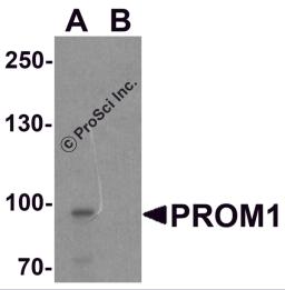 Western blot analysis of PROM1 in Jurkat cell lysate with PROM1 antibody at 1 &#956;g/ml in (A) the absence and (B) the presence of blocking peptide.