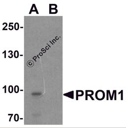 Western blot analysis of PROM1 in Jurkat cell lysate with PROM1 antibody at 1 μg/ml in (A) the absence and (B) the presence of blocking peptide.