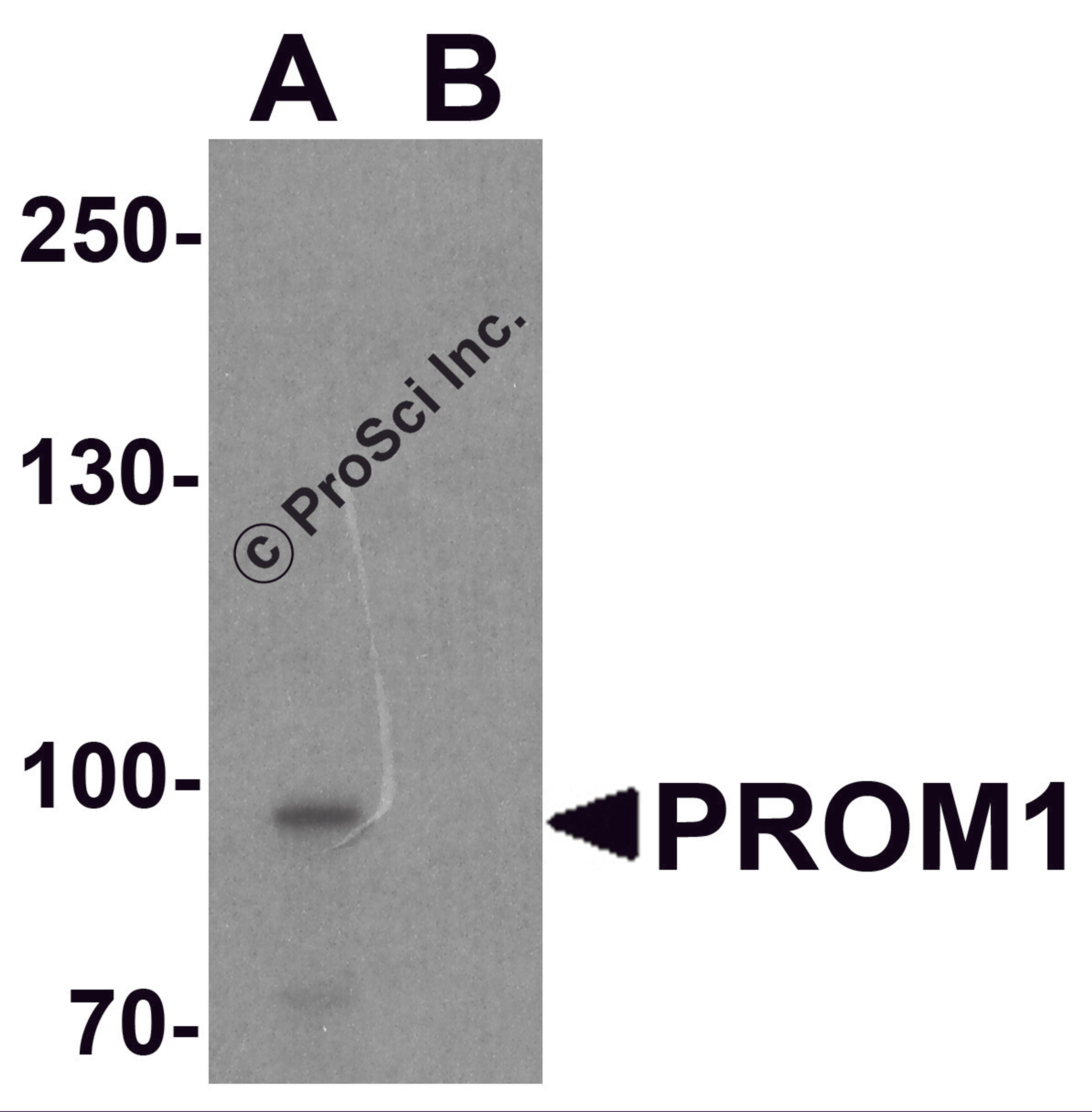 Western blot analysis of PROM1 in Jurkat cell lysate with PROM1 antibody at 1 μg/ml in (A) the absence and (B) the presence of blocking peptide.