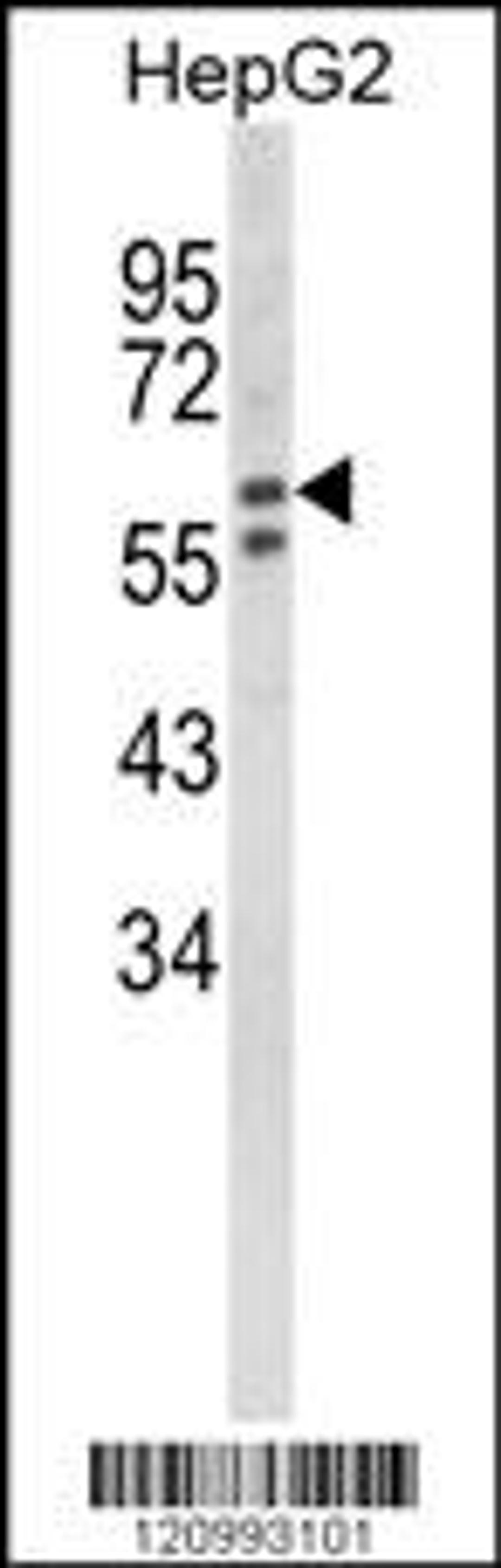 Western blot analysis of HEXA Antibody in HepG2 cell line lysates (35ug/lane)