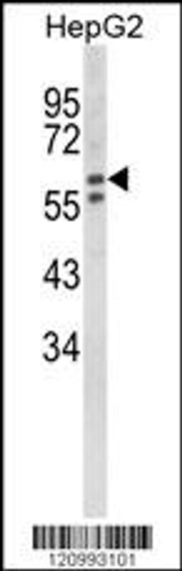 Western blot analysis of HEXA Antibody in HepG2 cell line lysates (35ug/lane)