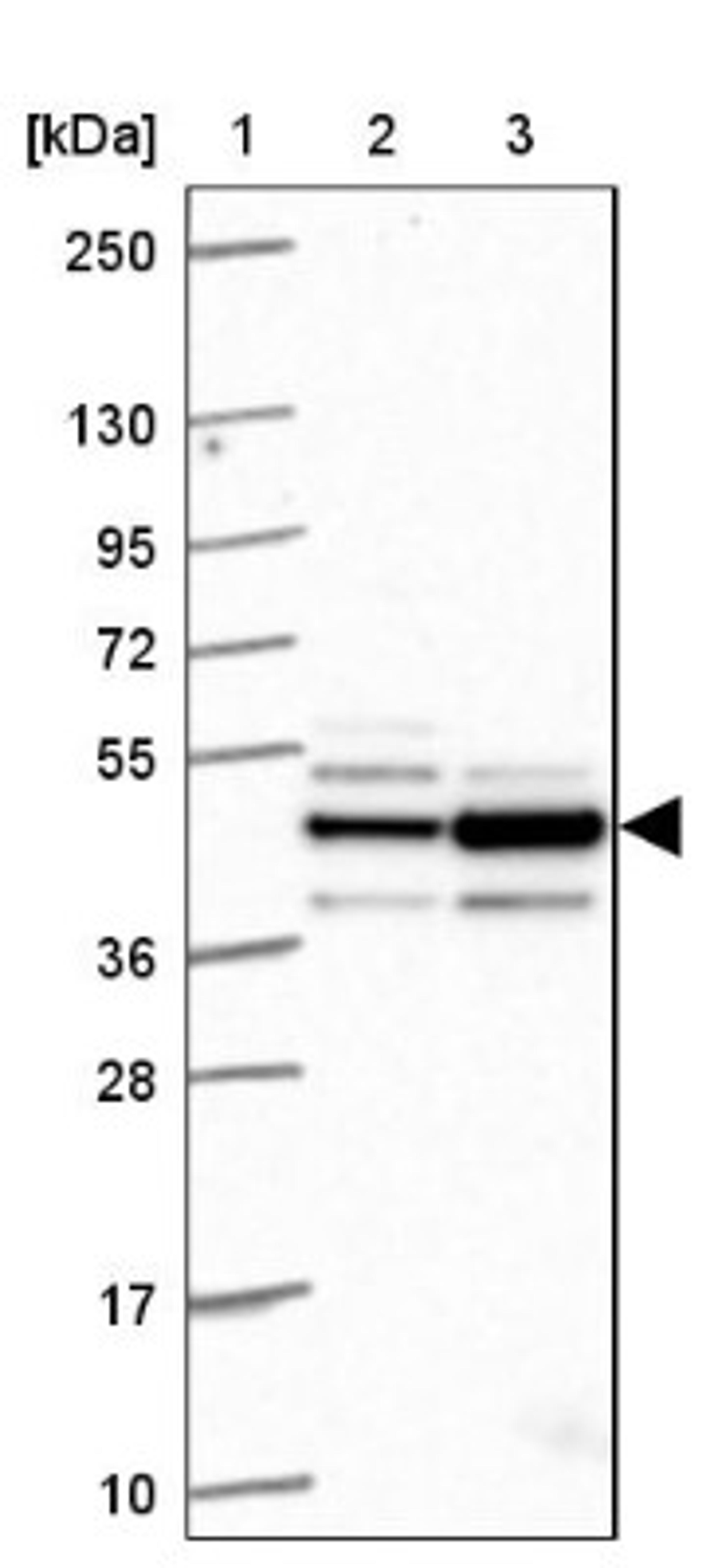 Western Blot: RRM2 Antibody [NBP2-47294] - Lane 1: Marker [kDa] 250, 130, 95, 72, 55, 36, 28, 17, 10.  Lane 2: Human cell line RT-4.  Lane 3: Human cell line U-251MG.