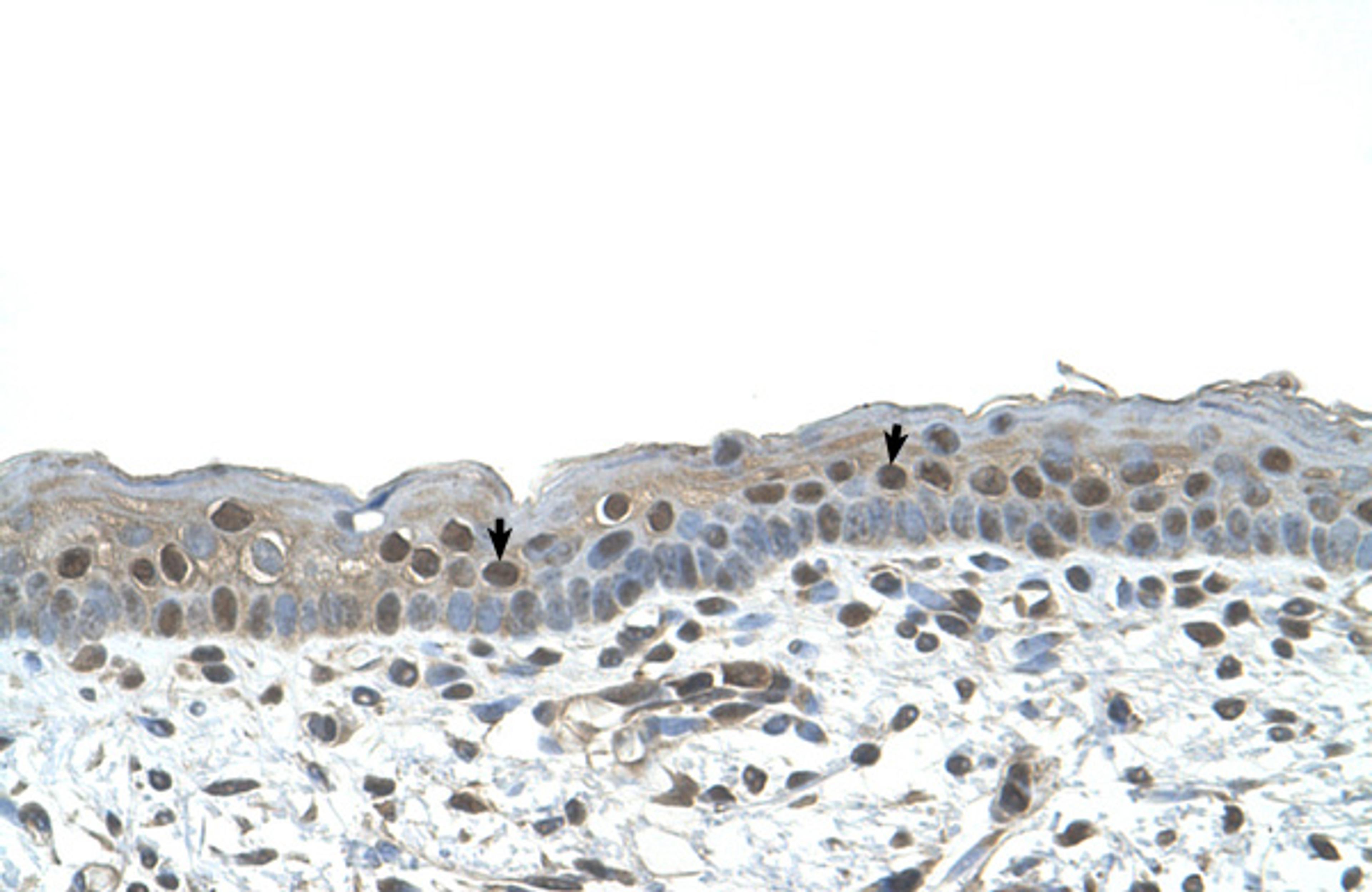 Antibody used in IHC on Human Skin.