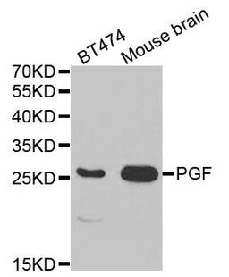 Western blot analysis of extracts of various cell lines using PGF antibody