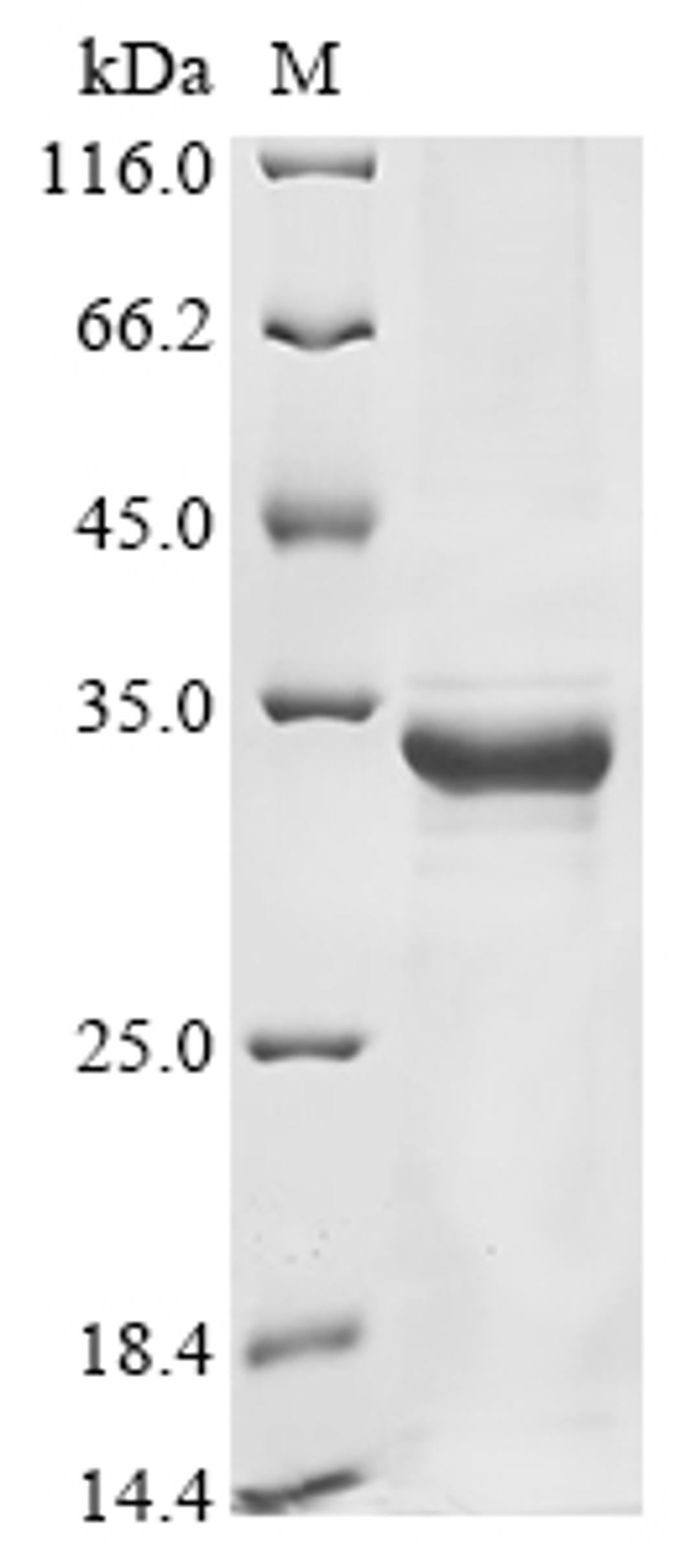 (Tris-Glycine gel) Discontinuous SDS-PAGE (reduced) with 5% enrichment gel and 15% separation gel.