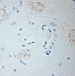 Immunohistochemistry-Paraffin: BDKRB2 Antibody [NBP1-46328] - Rat spinal cord (paraffin section) using Rabbit antibody to c-terminal region of BDKRB2 (B2 bradykinin receptor): whole serum at 1 : 200 dilution incubated overnight at room temperature, developed with DAB/Ni and counterstained with hem