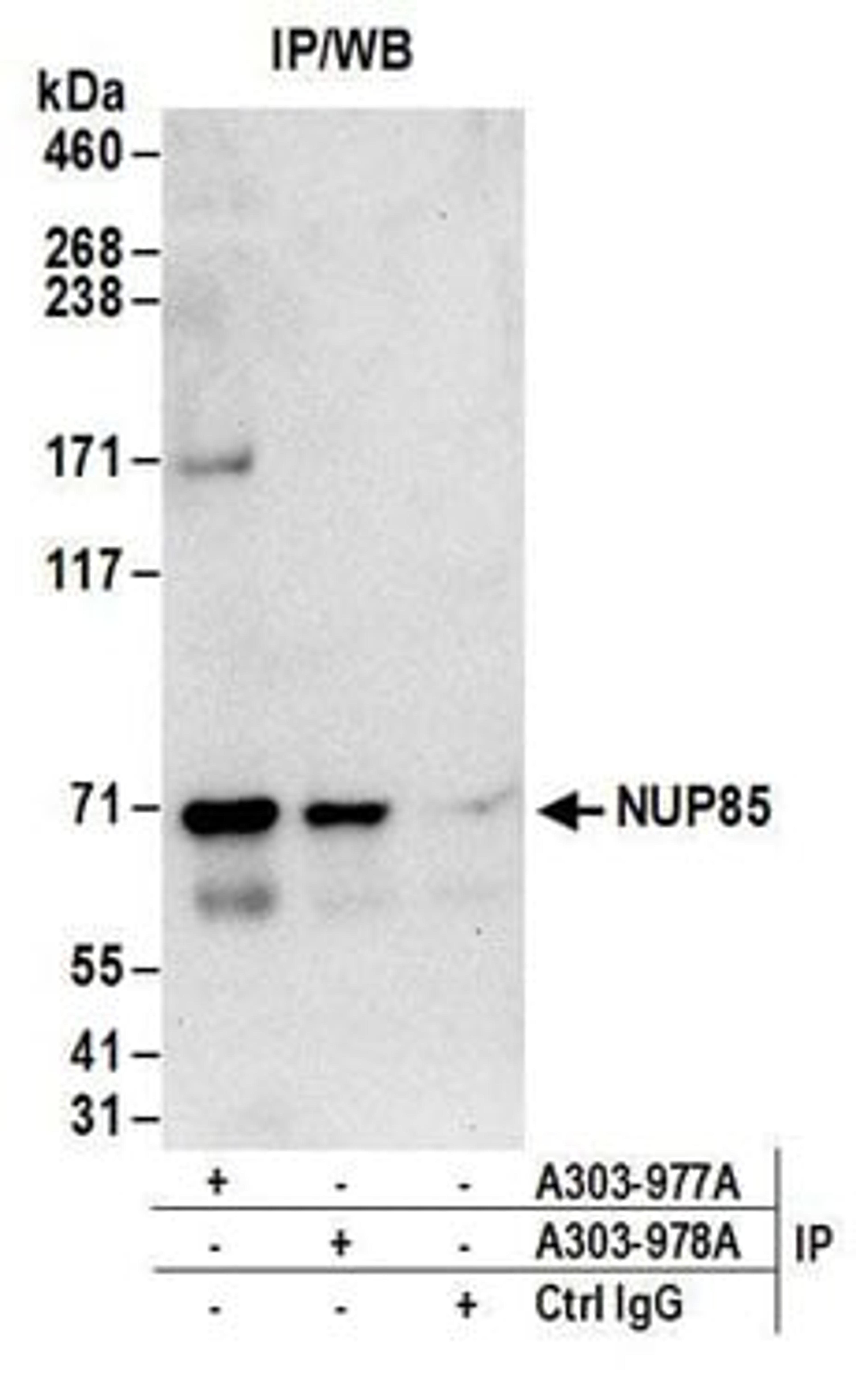 Detection of human NUP85 by western blot of immunoprecipitates.