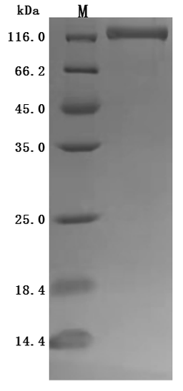 (Tris-Glycine gel) Discontinuous SDS-PAGE (reduced) with 5% enrichment gel and 15% separation gel.
