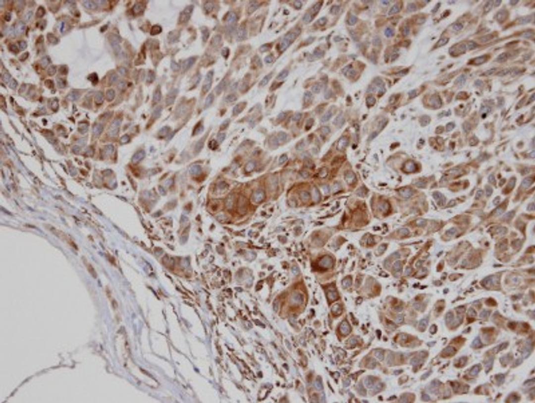 Immunohistochemistry-Paraffin: PTOP Antibody [NBP1-32165] - Paraffin-embedded A549 xenograft, using antibody at 1:100 dilution.