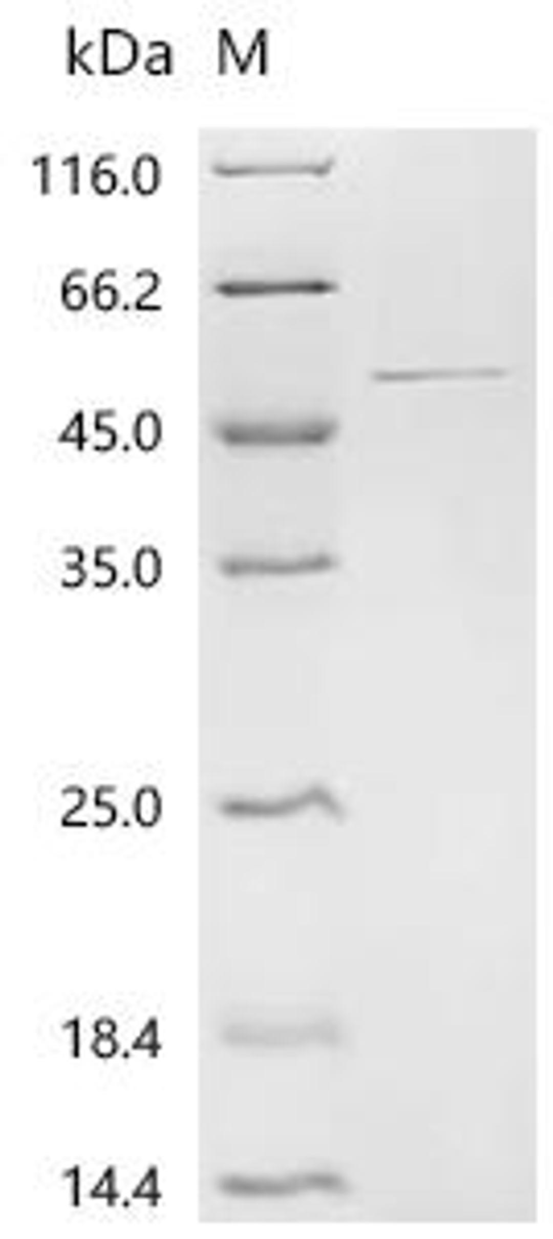 (Tris-Glycine gel) Discontinuous SDS-PAGE (reduced) with 5% enrichment gel and 15% separation gel.