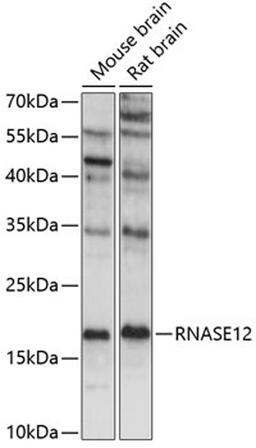 Western blot - RNASE12 antibody (A14607)