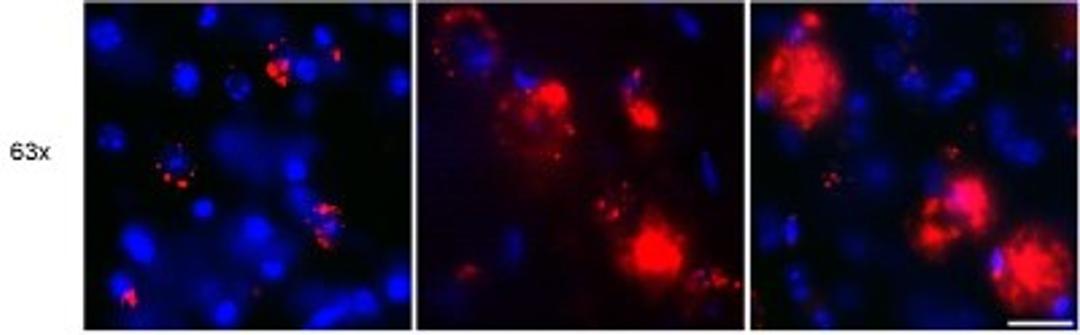 Immunocytochemistry/Immunofluorescence: beta Amyloid Antibody (MOAB-2) [NBP2-13075] - Immunofluorescent detection of beta Amyloid with MOAB-2 in the subiculim of 1-, 2- and 4- month old 5xFAD mice.  Scale bar 20 um (from PMID: 22423893).