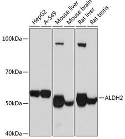 Western blot - ALDH2 Rabbit mAb (A11500)