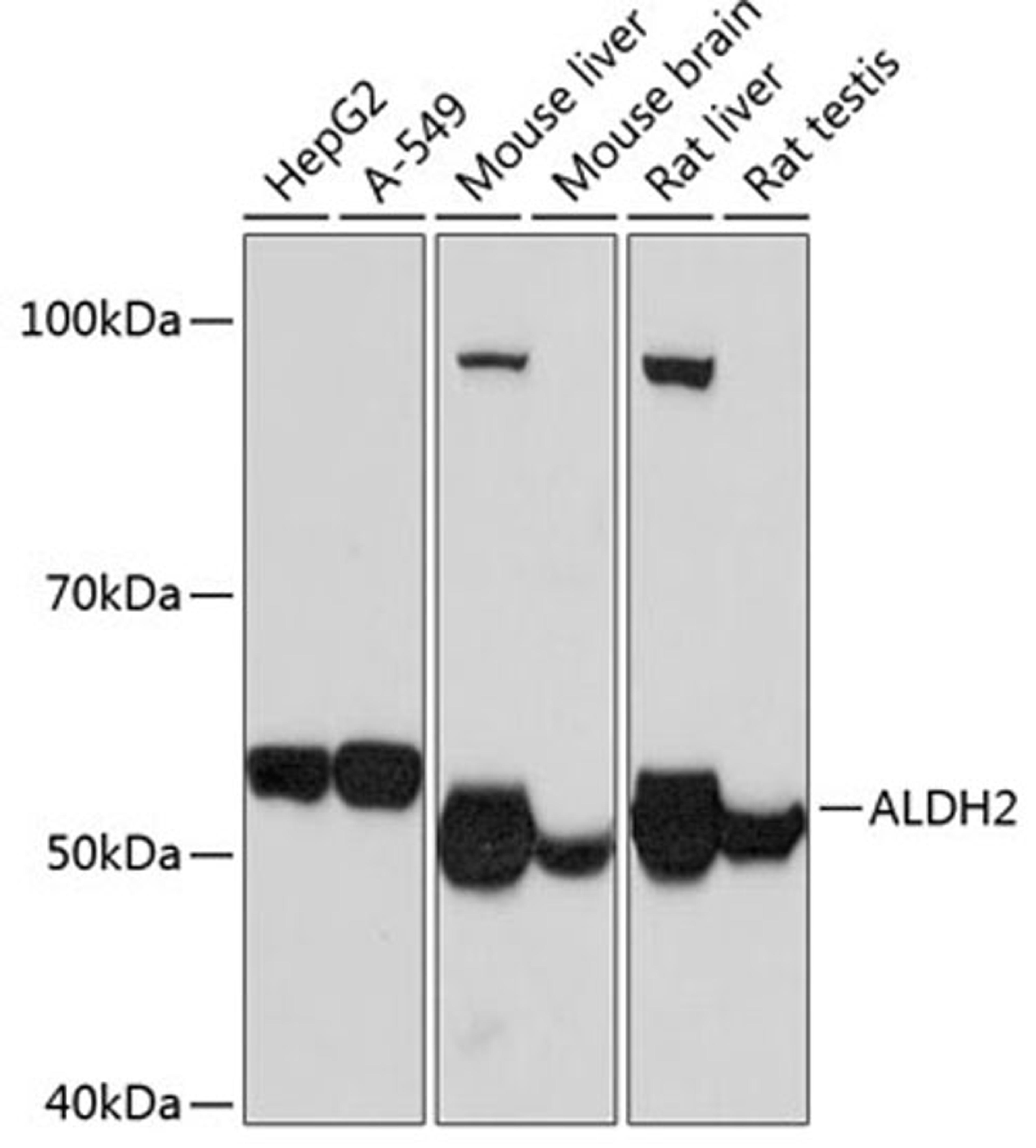 Western blot - ALDH2 Rabbit mAb (A11500)