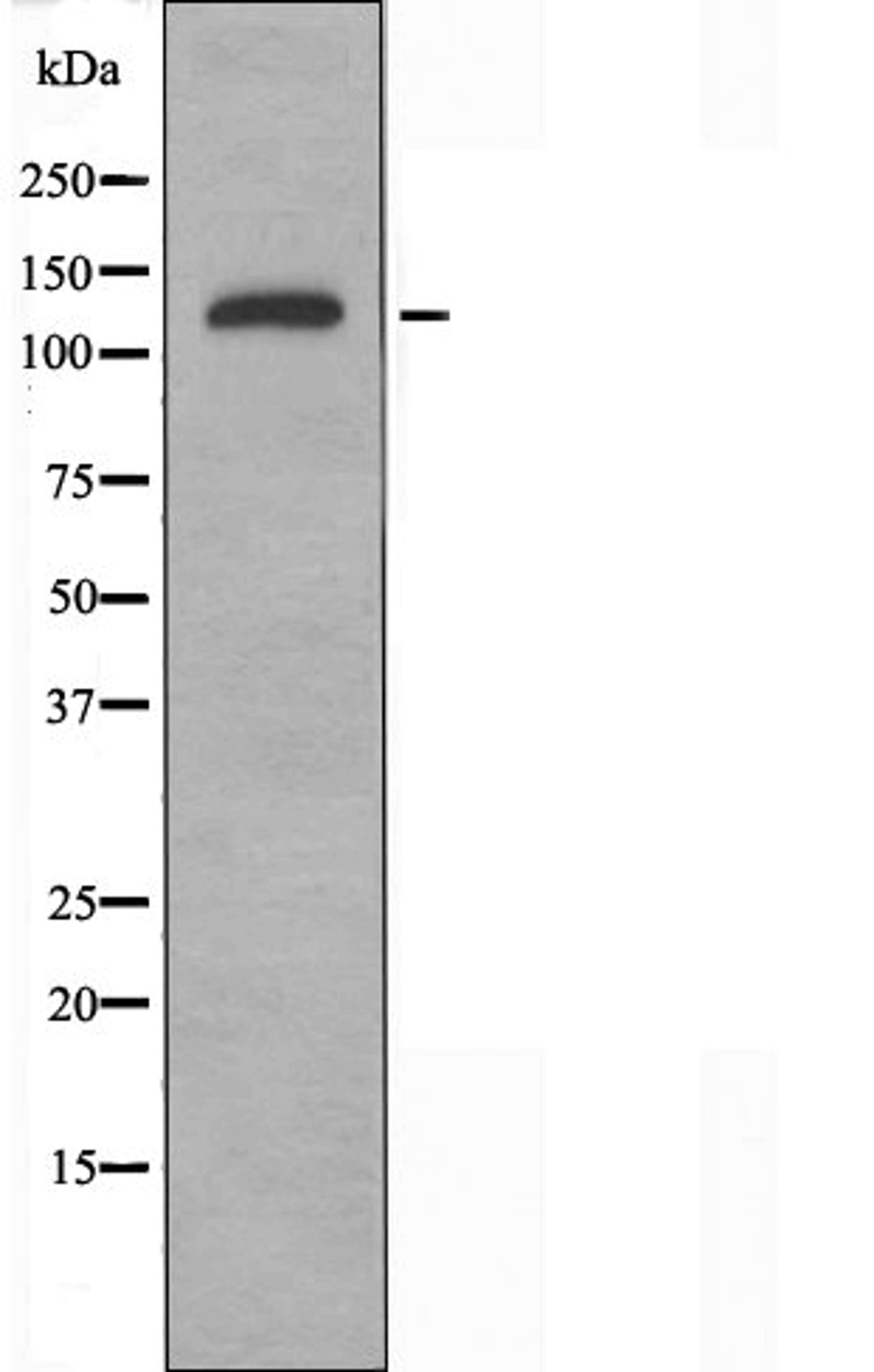 Western blot analysis of HUVEC cells using Collagen XX Alpha1 antibody