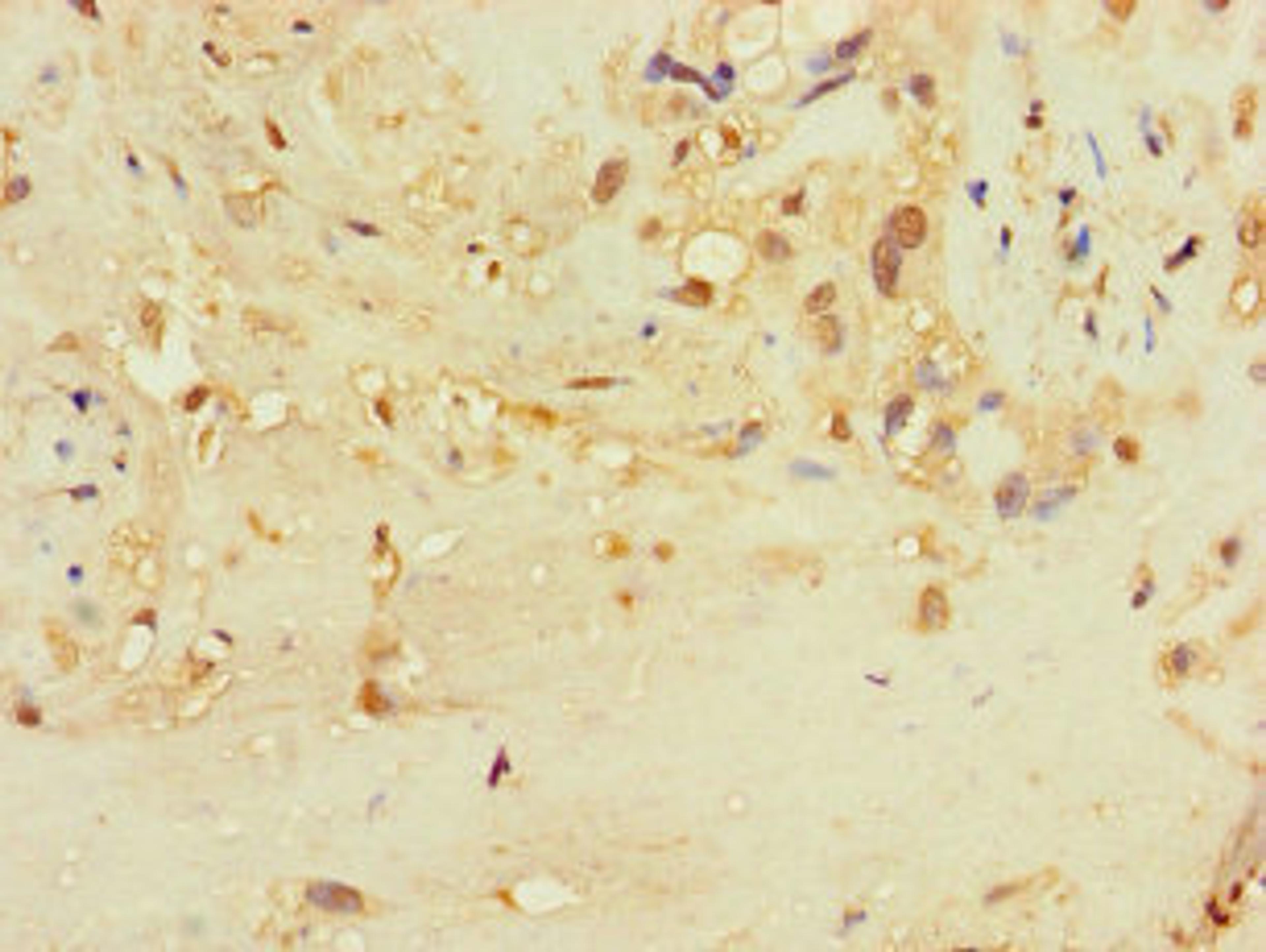 Immunohistochemistry of paraffin-embedded human placenta tissue using CSB-PA842746LA01HU at dilution of 1:100