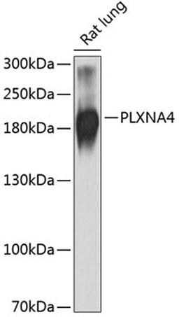 Western blot - PLXNA4 antibody (A9990)