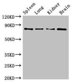 Western Blot. Positive WB detected in: Mouse spleen tissue, Mouse lung tissue, Mouse kidney tissue, Mouse brain tissue. All lanes: PRMT7 antibody at 6.2ug/ml. Secondary. Goat polyclonal to rabbit IgG at 1/50000 dilution. Predicted band size: 79, 63, 74, 64 kDa. Observed band size: 79 kDa.