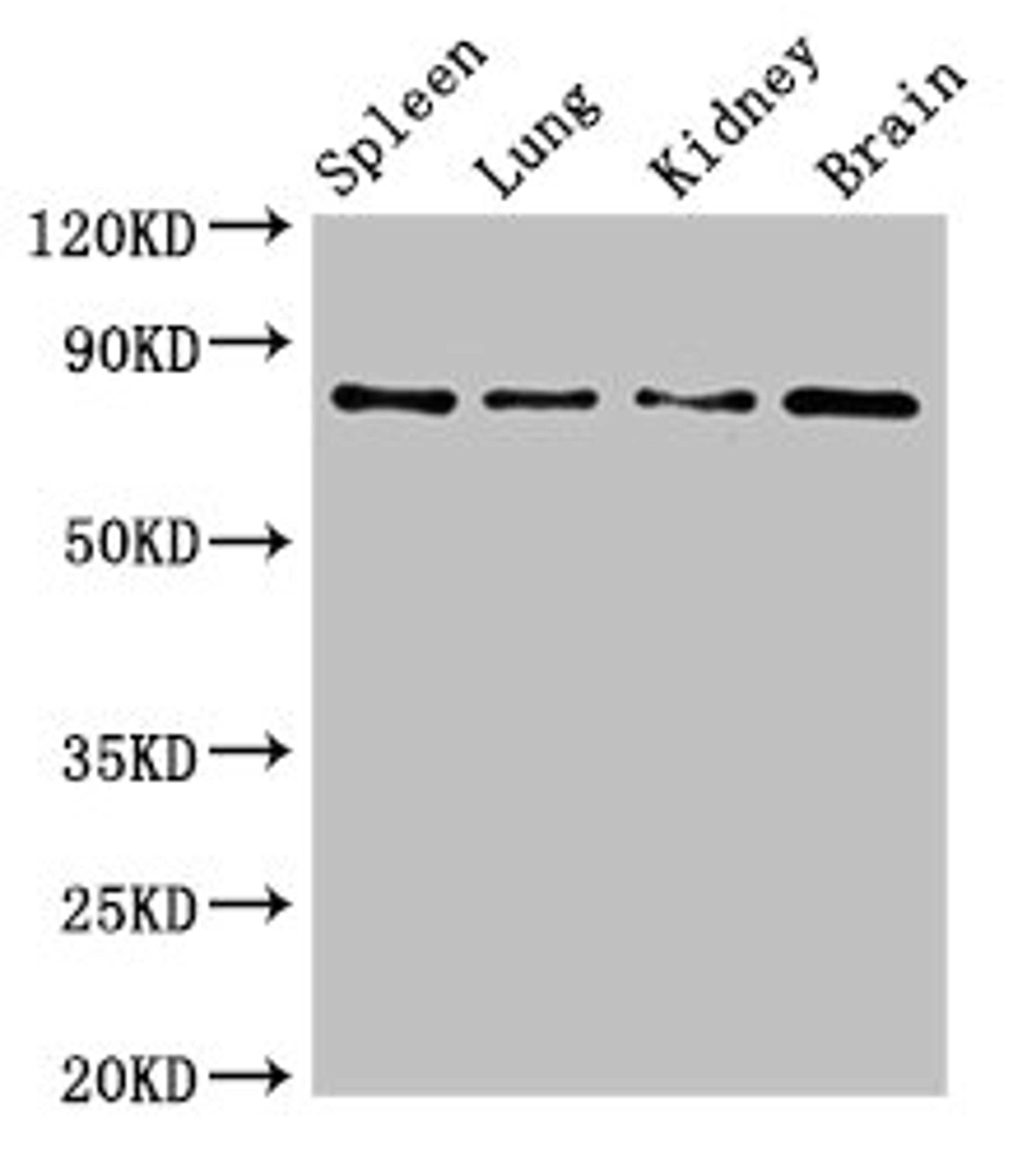 Western Blot. Positive WB detected in: Mouse spleen tissue, Mouse lung tissue, Mouse kidney tissue, Mouse brain tissue. All lanes: PRMT7 antibody at 6.2ug/ml. Secondary. Goat polyclonal to rabbit IgG at 1/50000 dilution. Predicted band size: 79, 63, 74, 64 kDa. Observed band size: 79 kDa.