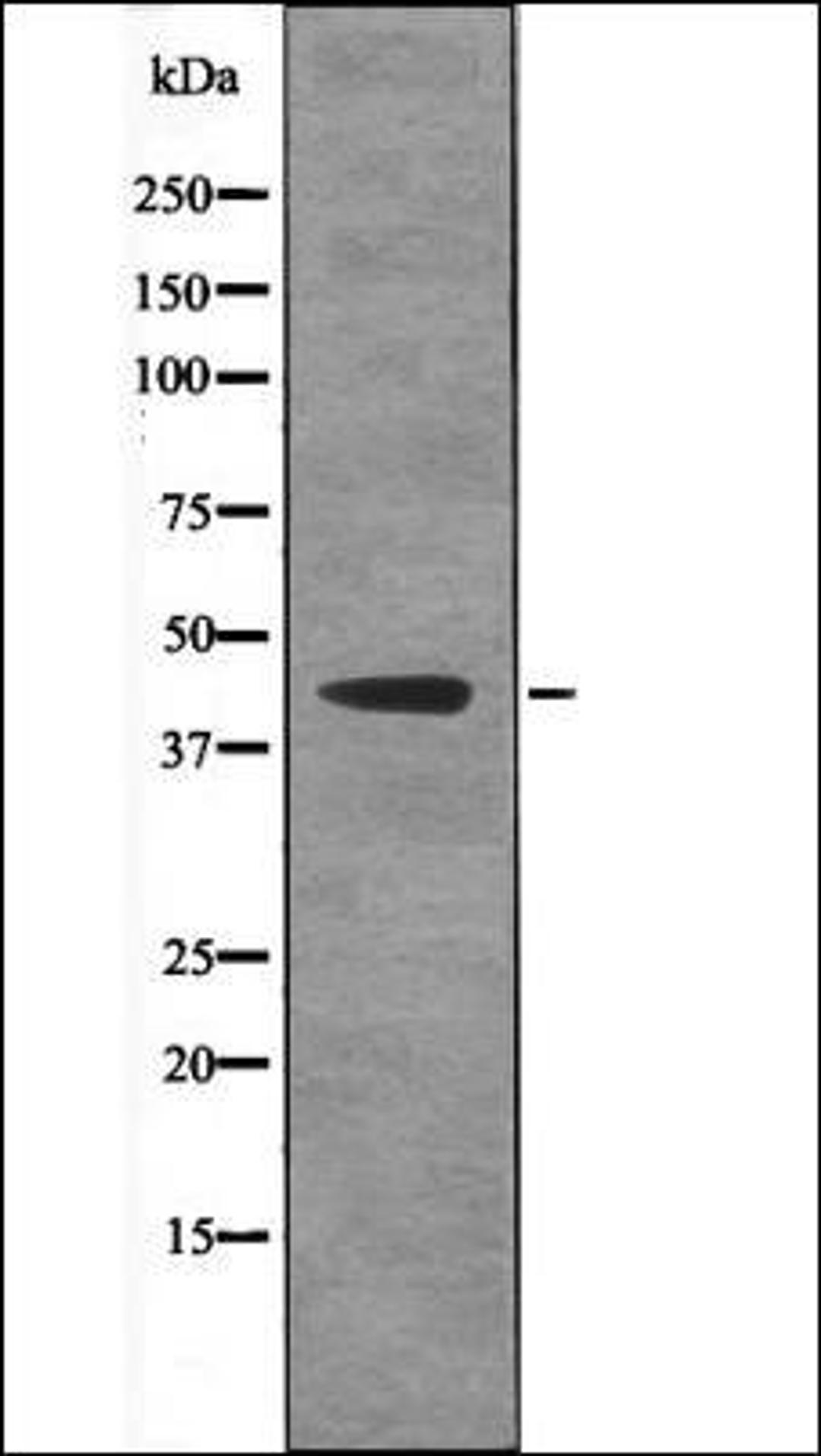 Western blot analysis of LPS treated HeLa whole cell lysates using Ataxin-3 -Phospho-Ser256- antibody