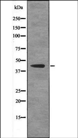 Western blot analysis of LPS treated HeLa whole cell lysates using Ataxin-3 -Phospho-Ser256- antibody