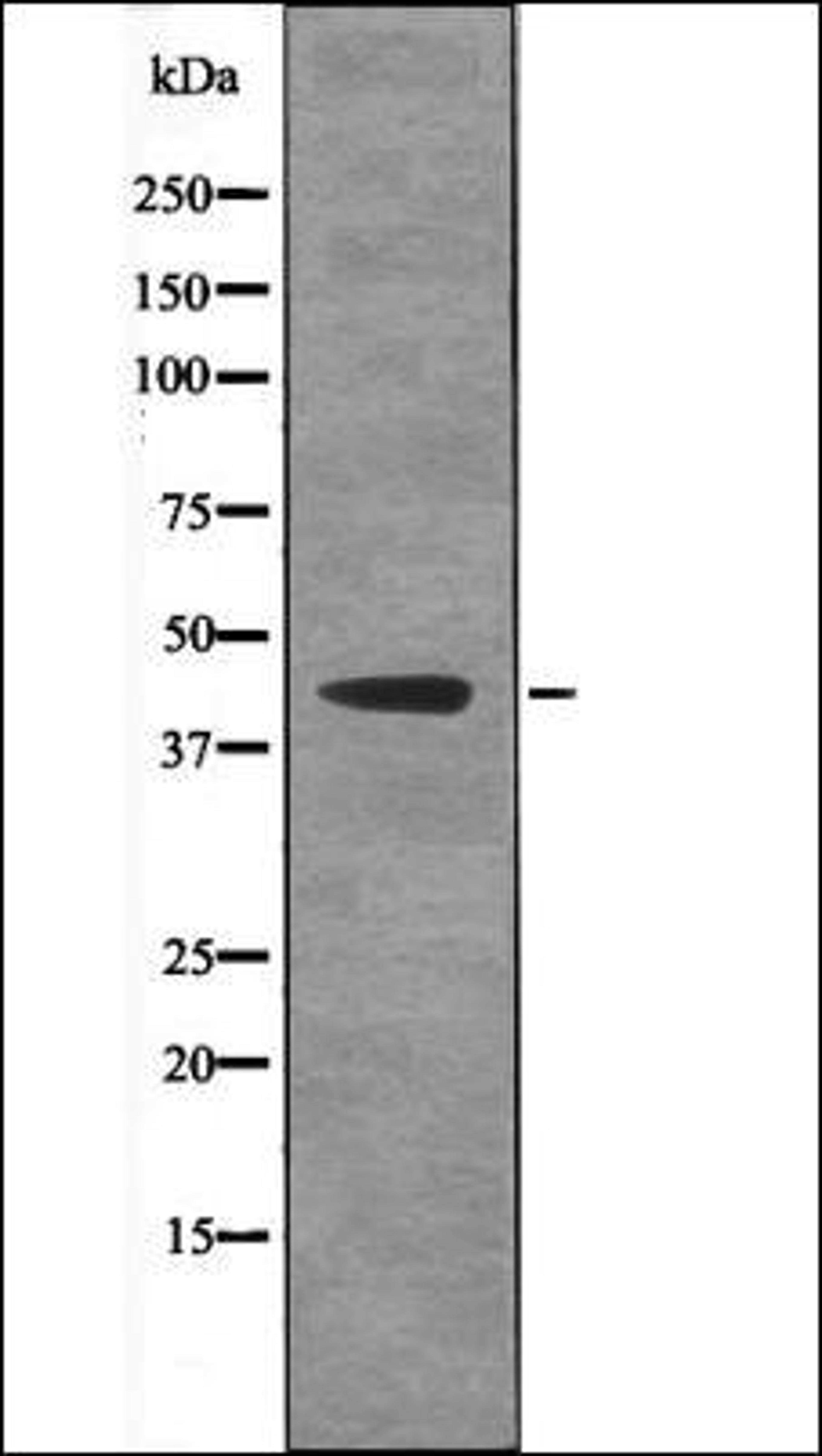 Western blot analysis of LPS treated HeLa whole cell lysates using Ataxin-3 -Phospho-Ser256- antibody